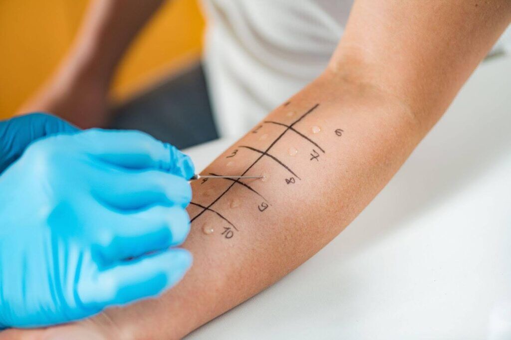 Environmental Allergy Testing In Alexandria, VA and Washington DC