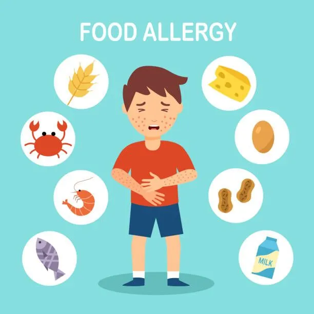 food allergies