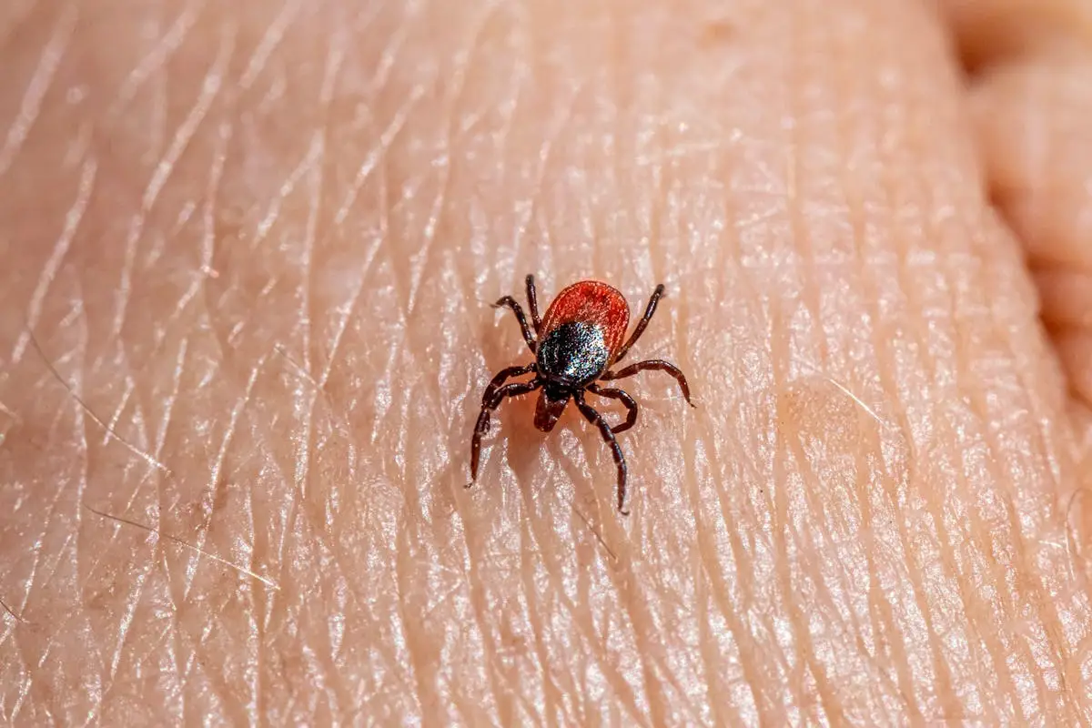 Alpha Gal or red meat tick bite