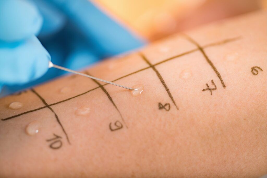 how long does allergy testing take