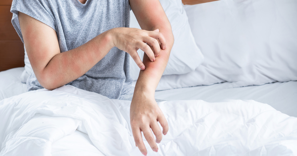 How to Get Rid of Dust Mites